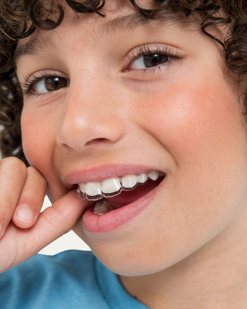 An extreme close-up shot of a young boy's open mouth and smile, showing a clear plastic aligner fitted precisely over his upper teeth as his finger gently rests near his lip.